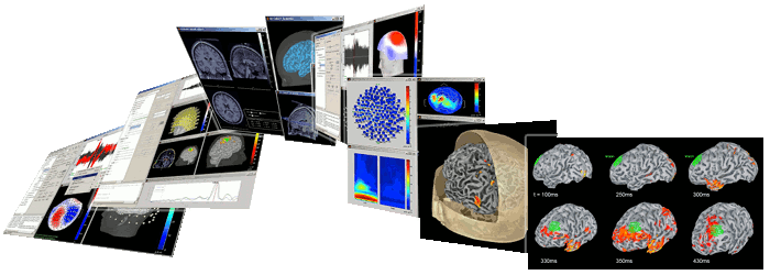 http://neuroimage.usc.edu/brainstorm/Introduction?action=AttachFile&do=get&target=brainstorm_banner.gif