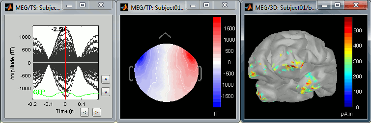 tsMisc.gif