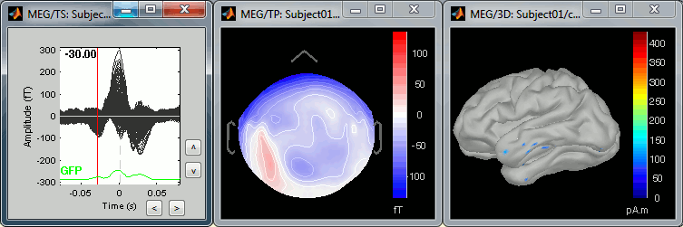 tsMisc.gif