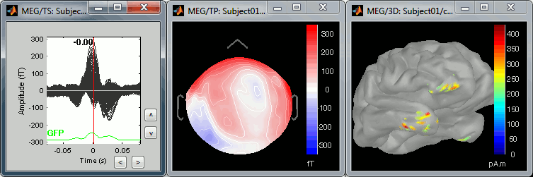 cardiacQRS.gif