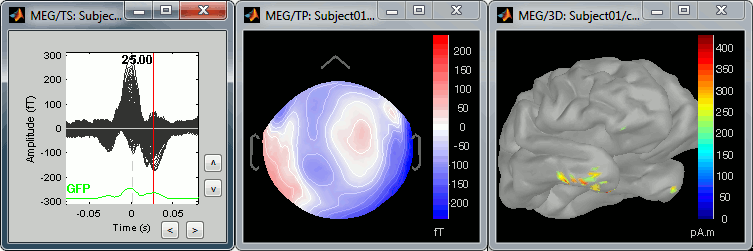 tsMisc.gif