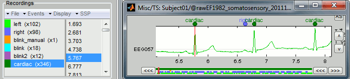 detectEcgDone.gif