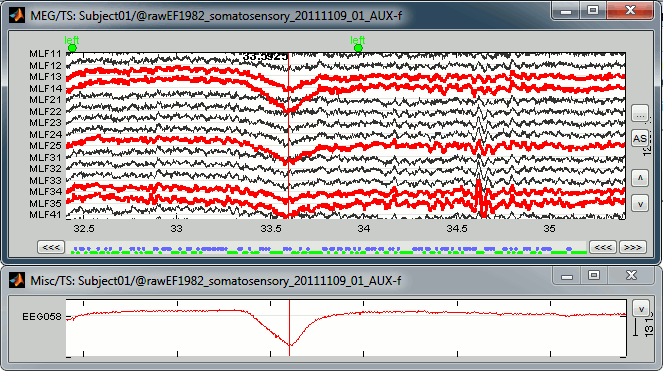 tsMisc.gif