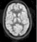 http://neuroimage.usc.edu/neuro/Molecular Imaging