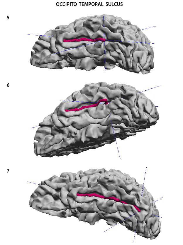 superior temporal sulcus