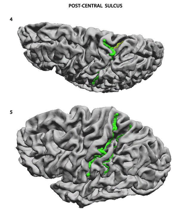 Postcentral Sulcus