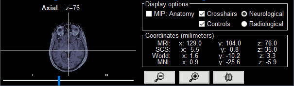 mriviewer_list.gif