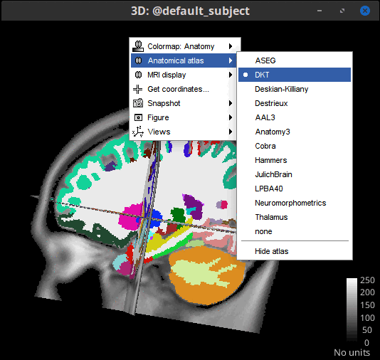 anat_atlas_3d_slices.gif