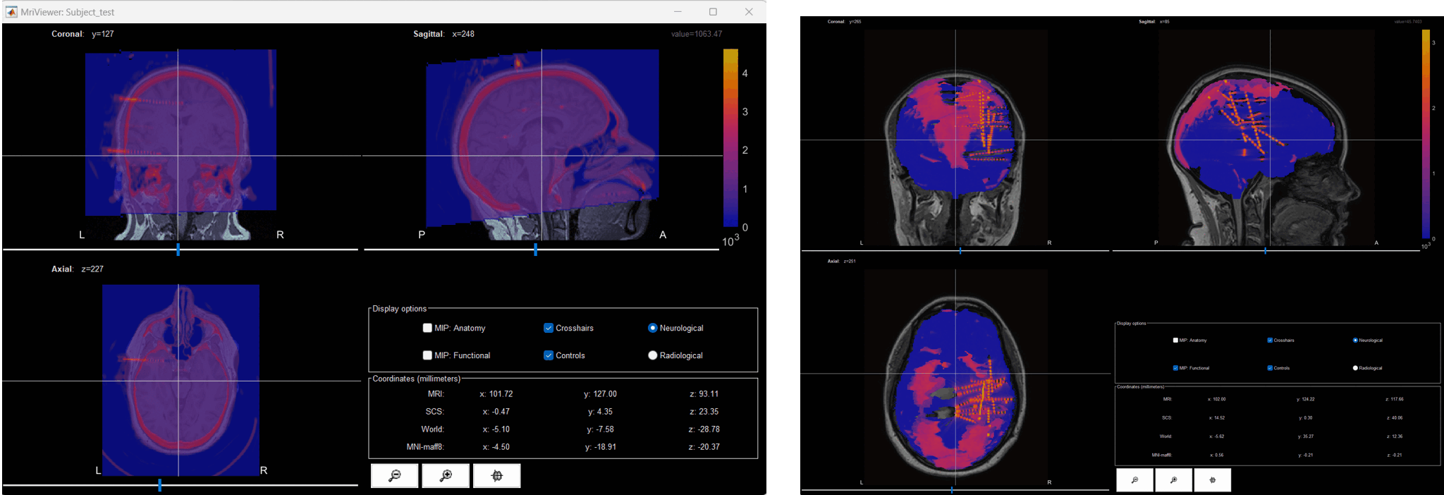 ct2mri_1.gif