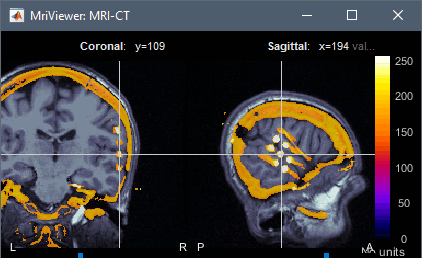 ct_mri.gif