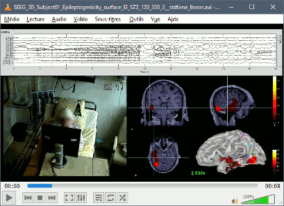 eeg_video.gif