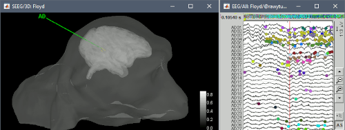 ephys_update.png