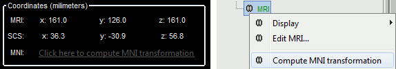 mni_coordinates.gif