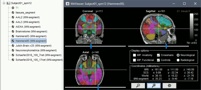 mni_parcellations.gif