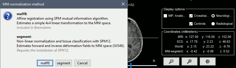 mni_segment.gif