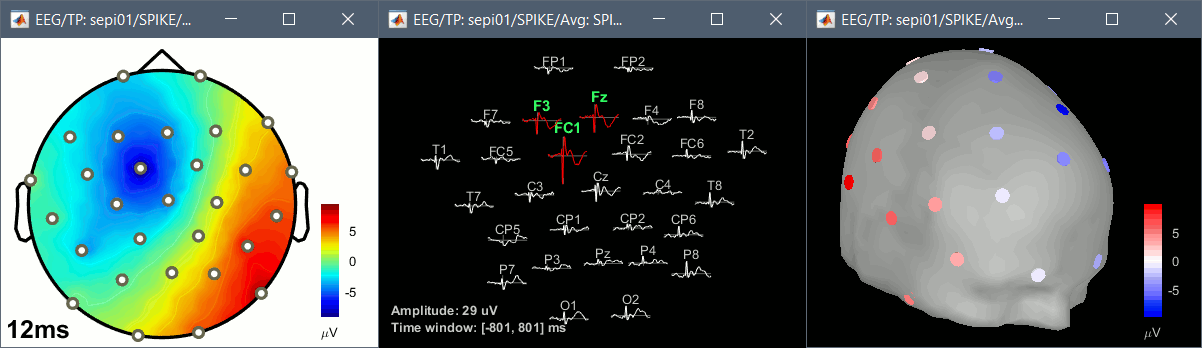 new_topo.gif