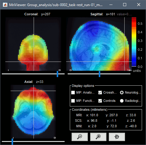 psd_volume_delta.gif