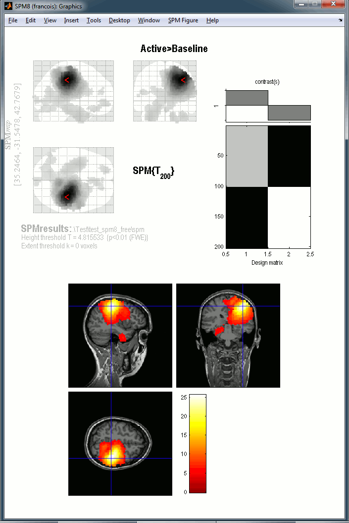 spmResults.gif