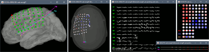 tutorial_ecog.gif