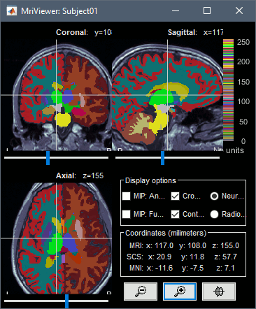 volume_atlas_aseg2.gif