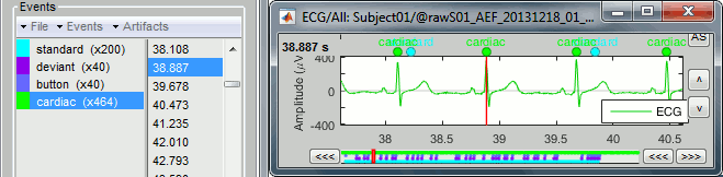 detect_ecg_done.gif