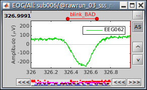 threshold_detect_blink.png