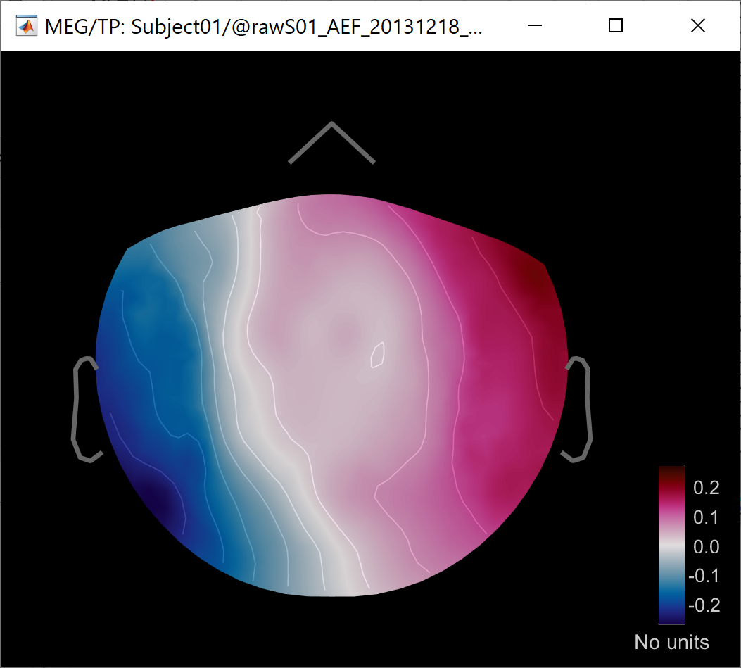 spp_run2_ecg_ncm.png