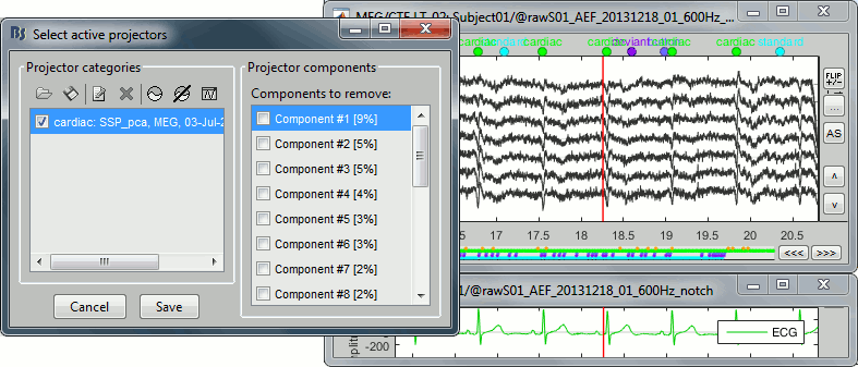 ssp_ecg_off.gif