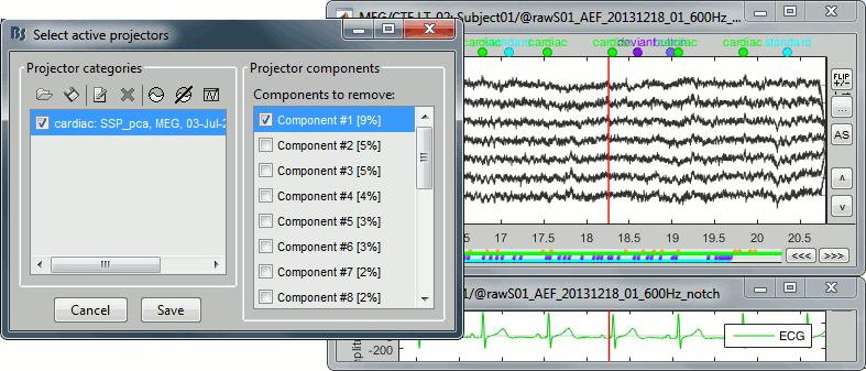 ssp_ecg_on.gif