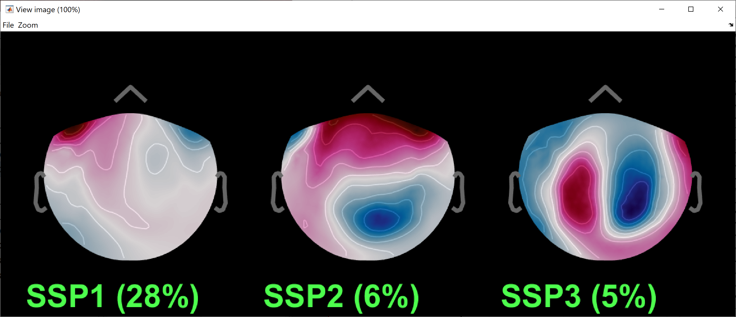 ssp_eoc_topo_ncm.png