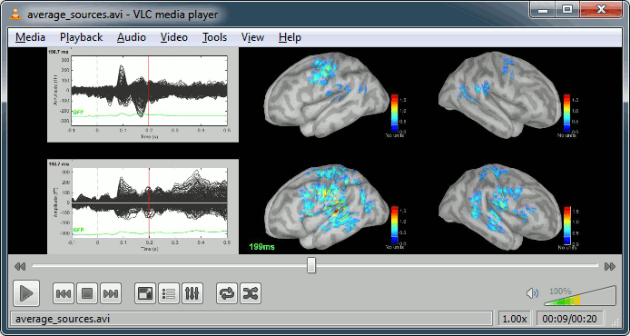 http://neuroimage.usc.edu/brainstorm/wikidocs/average_sources.avi