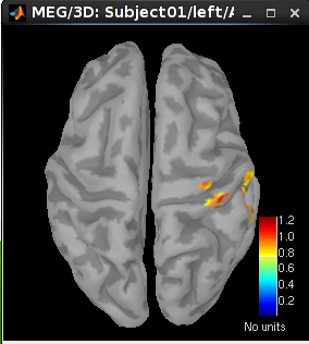 LCMV_left_constr_20ms.png