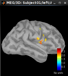 LCMV_left_constr_60ms.png