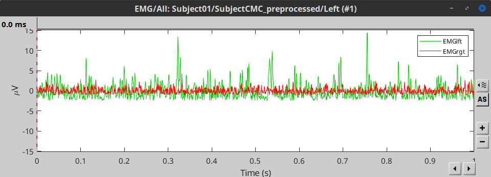 emg_trial_1.png