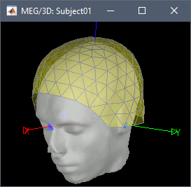 fig_registration.gif