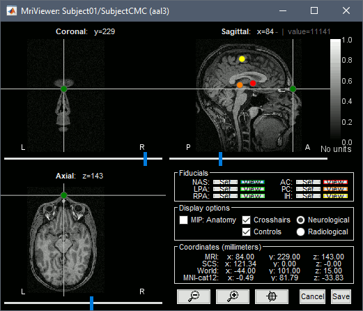 mri_viewer.gif