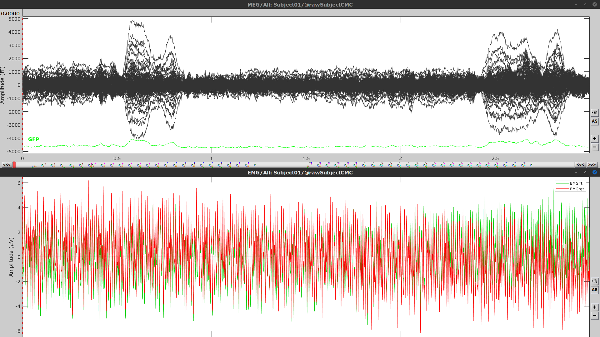 https://neuroimage.usc.edu/brainstorm/Tutorials/CorticomuscularCoherence?action=AttachFile&do=get&target=timeseries_meg_emg.png