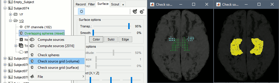 headmodel_grid.gif