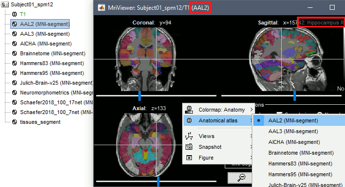 mni_list.gif