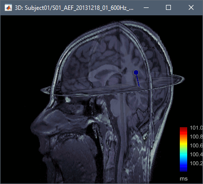 dipole_100ms.gif