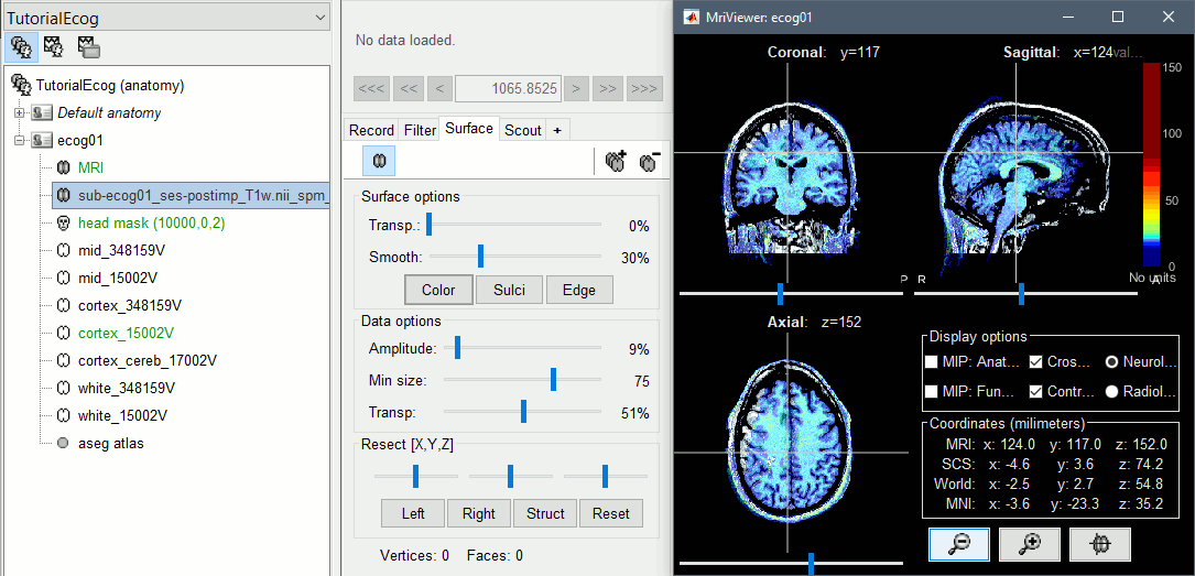 anat_overlay.gif