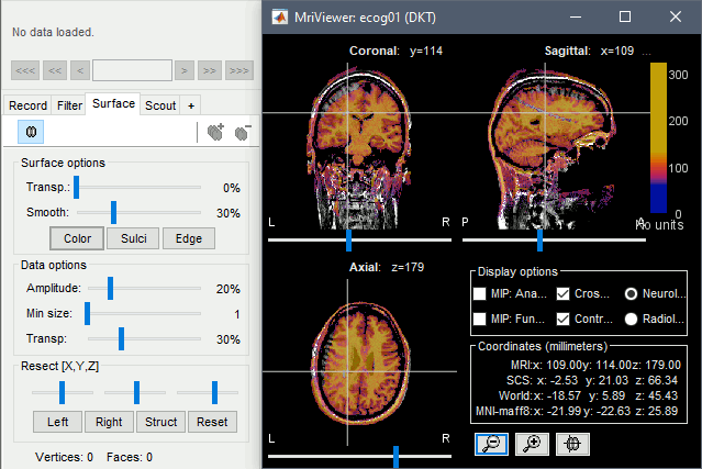 anat_overlay2.gif