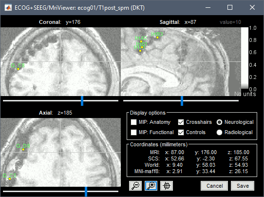 edit_ihc1.gif