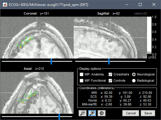 edit_ihc4.gif