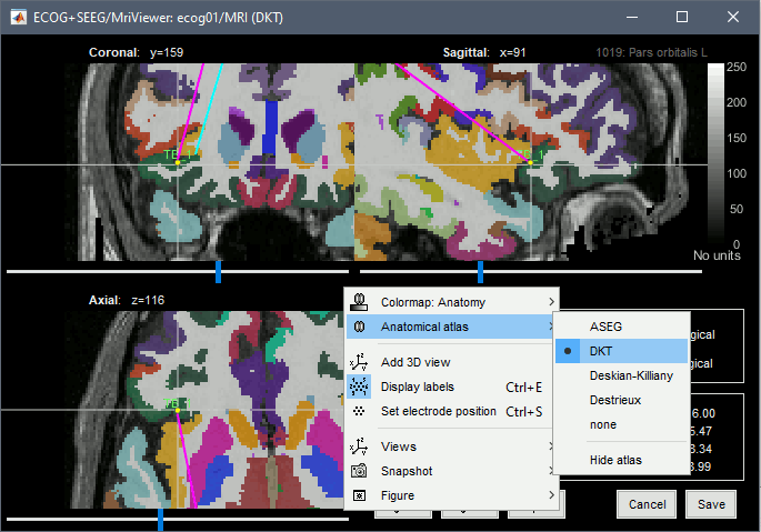 volatlas.gif