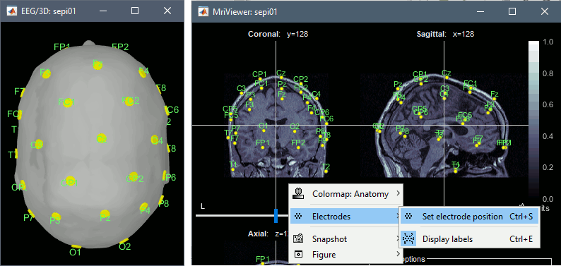 channel_mri.gif