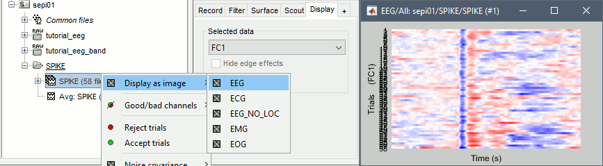 fc1_erpimage.gif