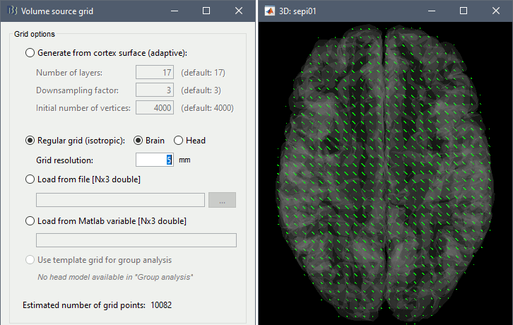 headmodel_vol3.gif