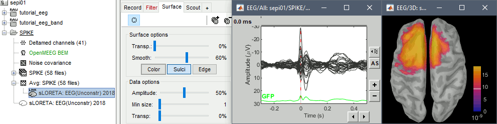 inverse2.gif