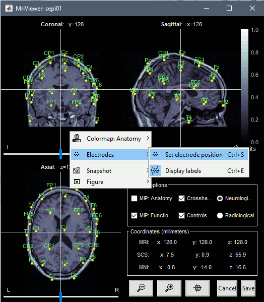 channel_mri.gif